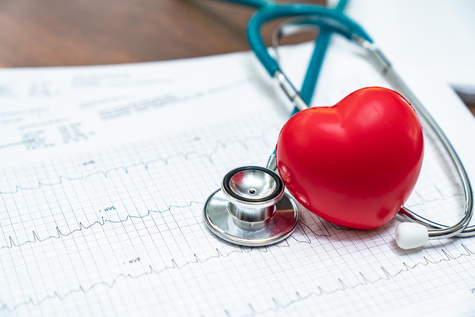 női egészségügyi kérdések tünetek szív
