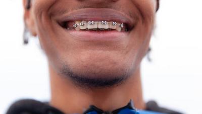 A person with braces