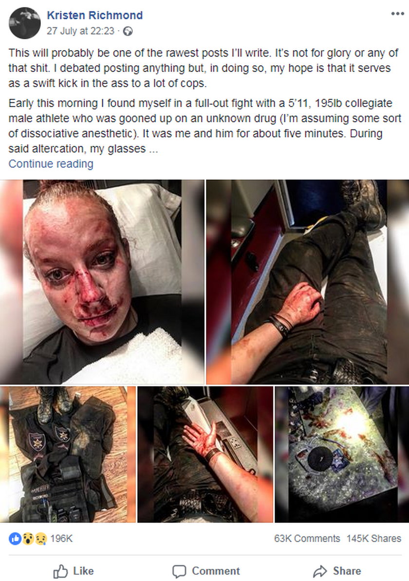 21-latek skatował policjantkę. Przerażające zdjęcia!