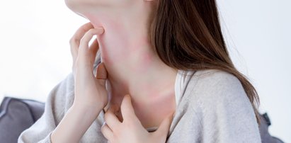 Dermatolodzy alarmują. Zmiany skórne mogą być objawem koronawirusa