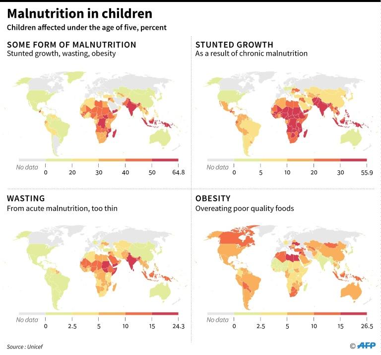 malnutrition in children