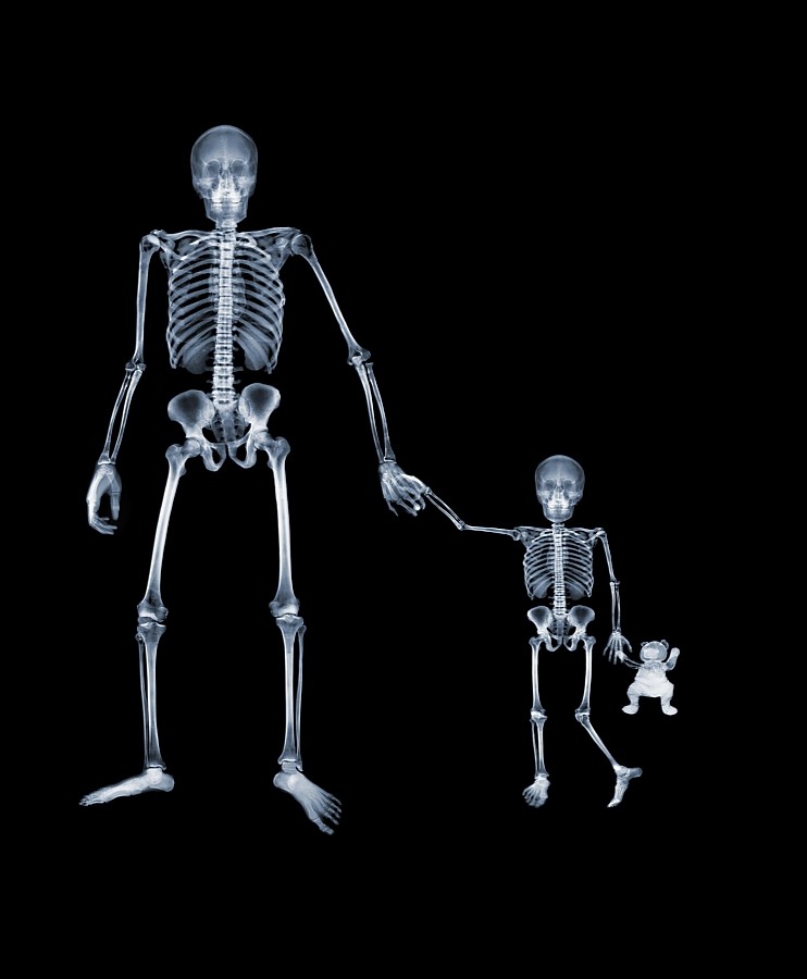 NICK VEASEY x-ray