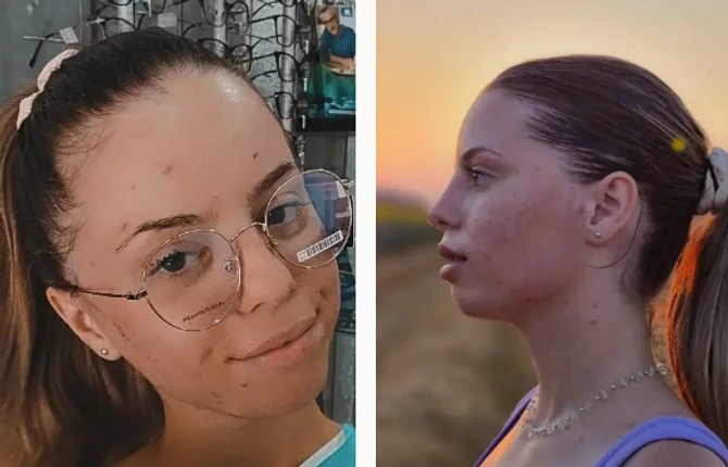 Todora je dugo imala problem sa licem