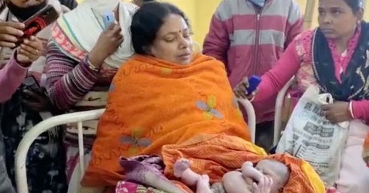 Inde Un bébé naît avec quatre bras et quatre jambes [Photos] Pulse