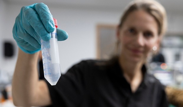 Donor sperme imao genetsku mutaciju koja izaziva rak