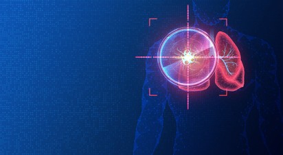 Mesterséges intelligencia: már a korai stádiumban felismerheti a rákot?