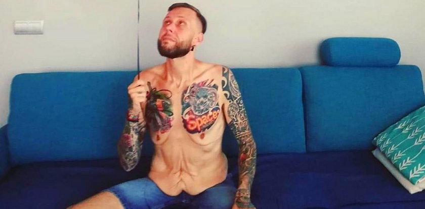 Uczestnik „Gogglebox” schudł ponad 140 kg. Pokazał zdjęcie brzucha