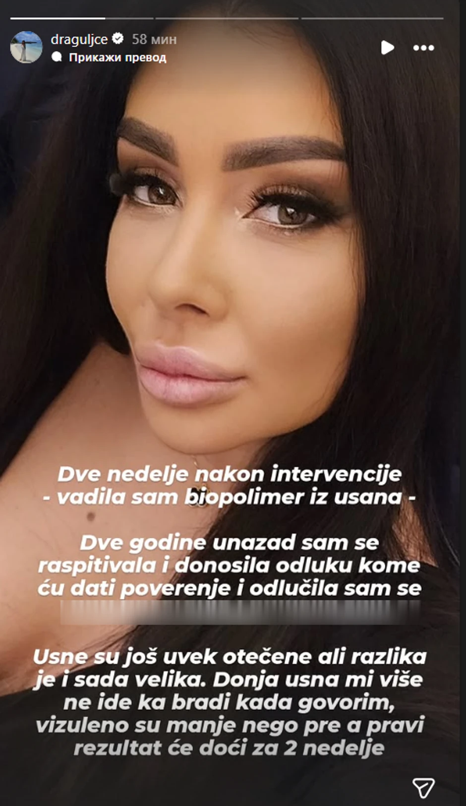 Zorica Dukić izvadila biopolimer