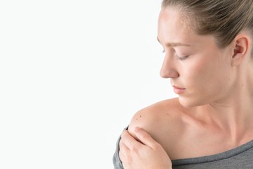 melanoma