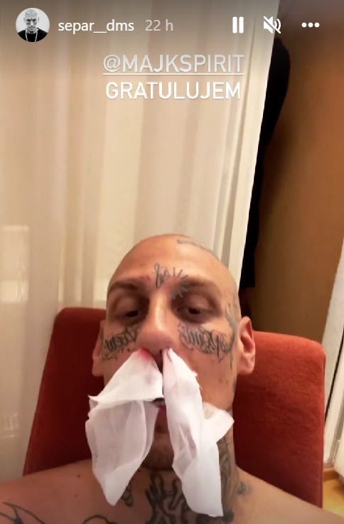 Raper prehovoril o problémoch, ktoré mal pred galavečerom.