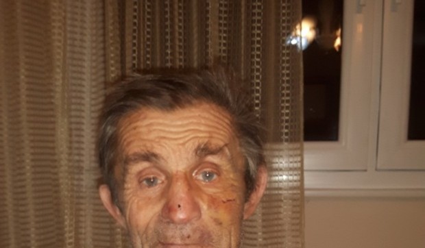 Prebijeni starac Radomir Radojevic selo Liplje01