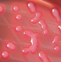 klebsiella-d000018D3df83debb4920