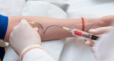Hemoglobina - normy, badanie, niski i wysoki poziom hemoglobiny