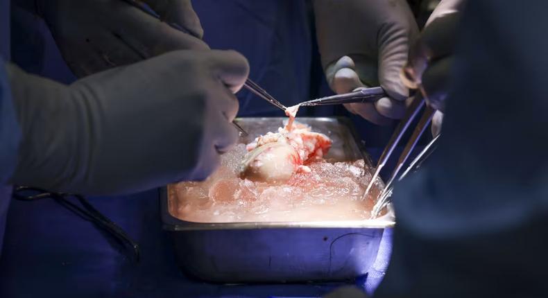 The pig kidney transplanted into Richard Slayman [MGH]