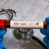 Značajan broj ljudi žive sa HIV-om, a da toga nisu svesni, zbog čega je rano i redovno testiranje ključno