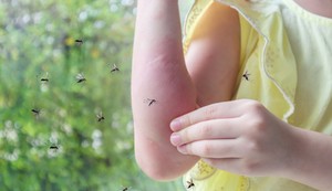 Komarci piju ljudsku krv jer im je potreban protein, vitalni gradivni blok za njihova jaja