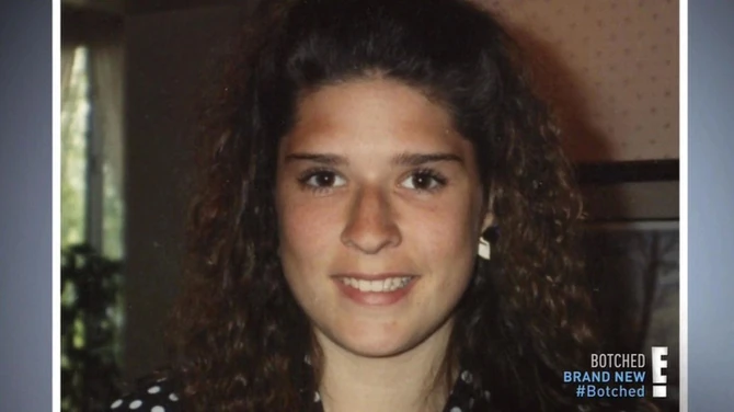 Ovako je njen nos izgledao nakon povreda