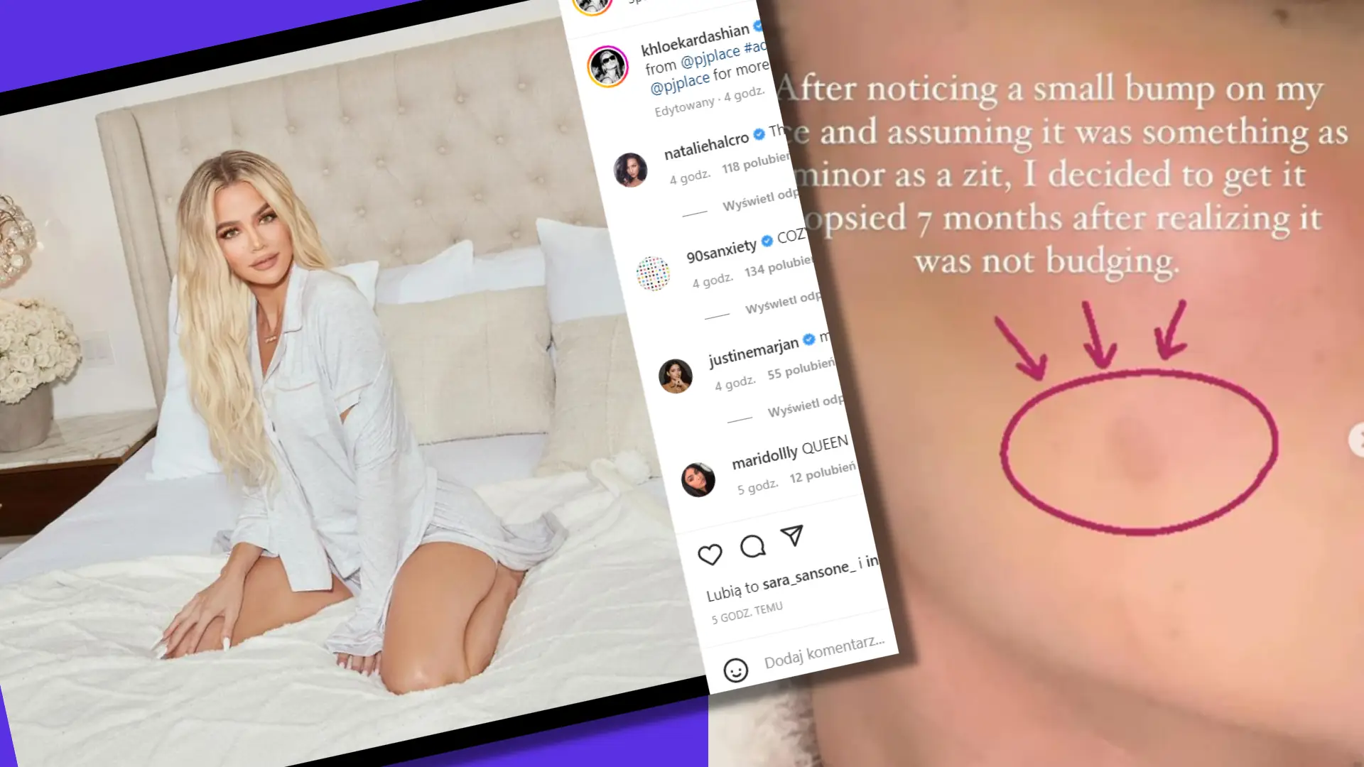 Khloe Kardashian miała nowotwór. Teraz apeluje do fanów: "Nikt nie ma taryfy ulgowej"