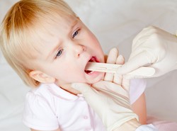 Objawy PIMS-TS są widoczne w jamie ustnej dziecka. Alarmujące symptomy