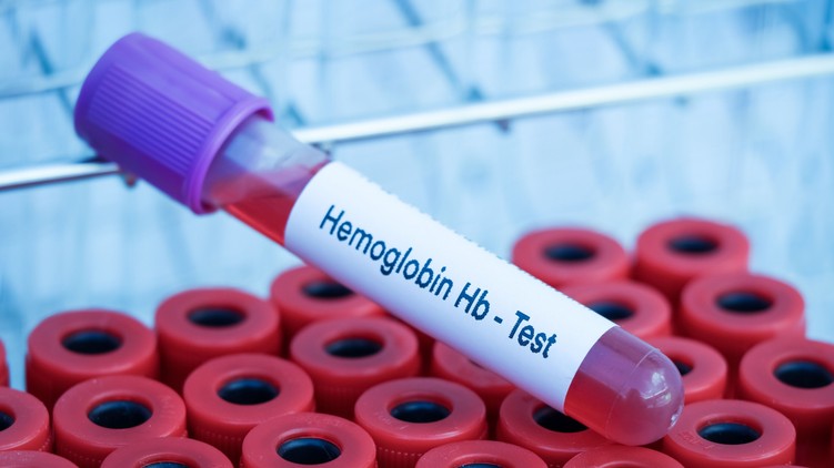 hemoglobin alacsony mikor veszélyes vérvétel vértranszfúzió