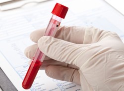 Radziwiłł zachęca do oddawania krwi