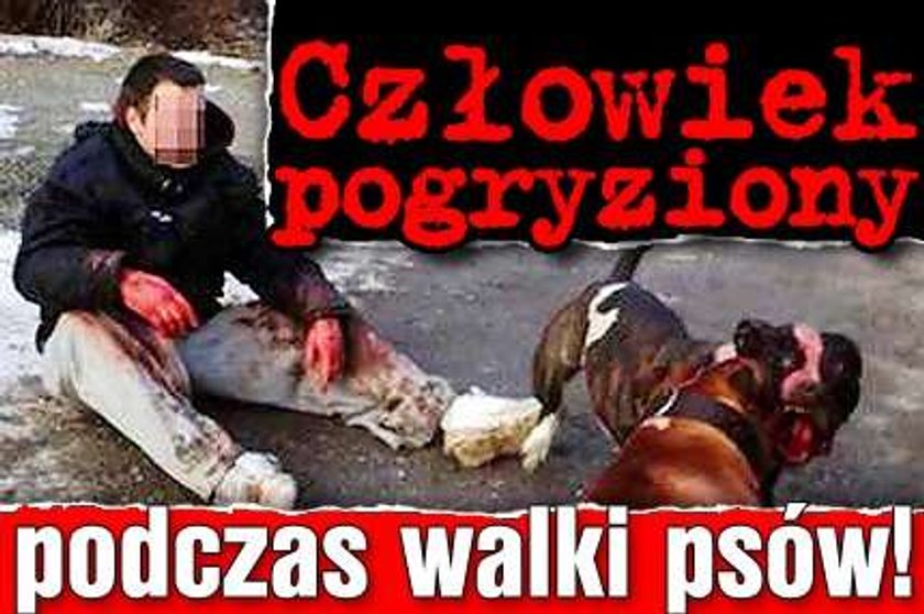 Człowiek pogryziony podczas walki psów!