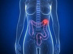 'Duża jest dynamika wzrostu zachorowalności na ten nowotwór'