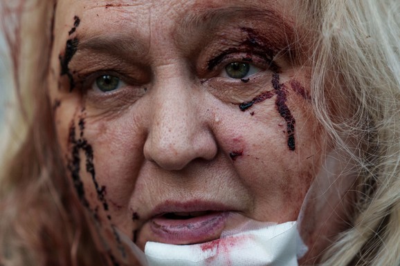 (FOTO) KRVAVIH LICA ISTRČAVALI IZ ZGRADA! Scene razaranja iz Kijeva obilaze svet, broje se mrtvi u Ukrajini: "U šoku sam"