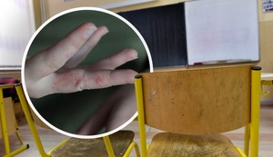 Šuga u vrtiću i školi u Beogradu, ilustracija 