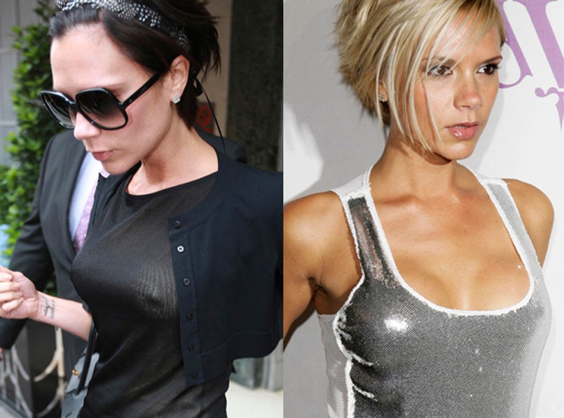 Dzieje biustu Victorii Beckham