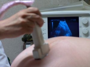 676877-ultrasound-1-d000000990eade0e4e76f