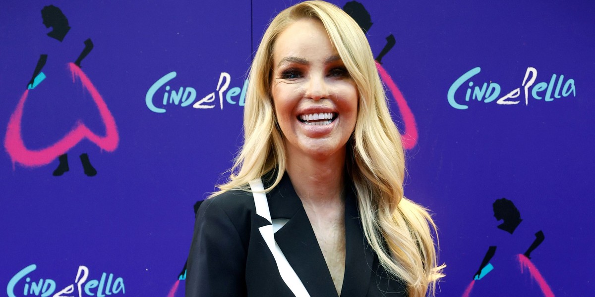 Katie Piper przeżyła prawdziwy horror. W 2008 roku w Londynie została oblana kwasem