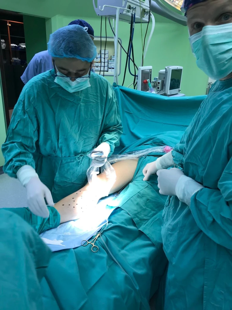 Laserska operacija vena