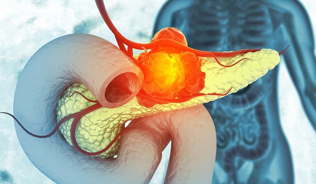 Aspirin oslobađa T ćelije od supresije TKSA2 - faktora zgrušavanja, i omogućava im da ubijaju ćelije raka