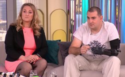 Nowa ręka z drukarki 3D. Jak powstaje?