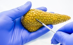 Naukowcy odkryli sposób na zagłodzenie raka