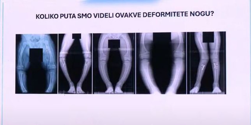 Prepoznavanje rerkih bolesti po izgledu nogu