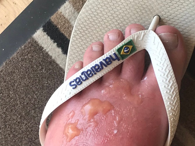 Kad ne brinete o koži.....