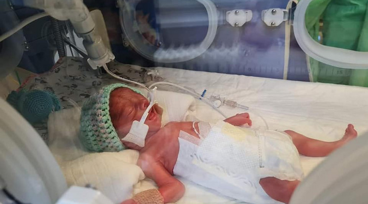 Máté 770 grammal született, három hónappal a kiírt időpont előtt jött világra