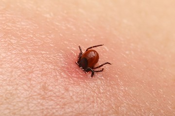 A kullancscsípés helyén pici rózsaszínes bőrpír van, ez Lyme-kór? Az orvos válaszol