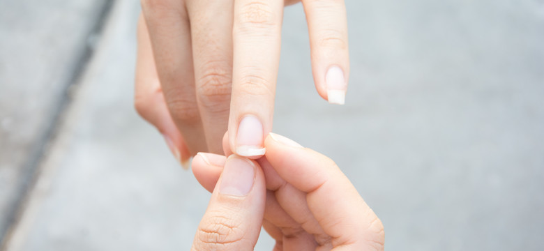 Rozdwajające się paznokcie. Poznaj sposoby na pozbycie się uciążliwego problemu