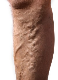viszer-lab-d0000116Ae3d967d2fd29