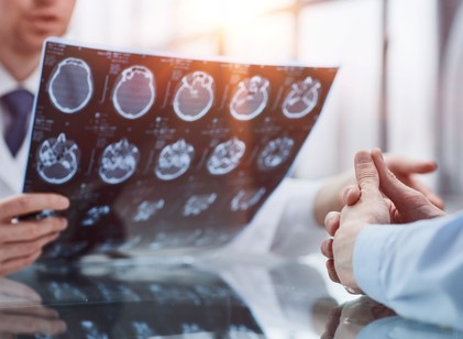 Nem csak fejfájás: 12 meglepő tünet, ami agydaganat jele is lehet című cikk nyitóképe