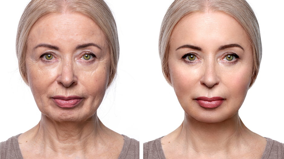 Kosmetyki z retinolem są naprawdę mocne i w kilka miesięcy poprawią wygląd skóry