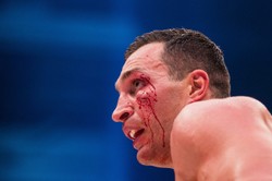 Władimir Kliczko przegrał z Tysonem Furym przez... żonę. WIDEO