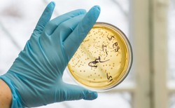 Jest szansa na antybiotyk przeciwko lekoopornym superbakteriom