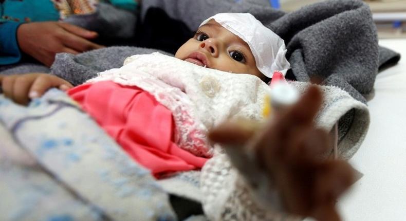 A Yemeni infant suspected of being infected with cholera, receives treatment at the Sabaeen Hospital in Sanaa, on June 13, 2017