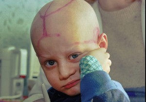 Alek Žloba sedi na dečjem odeljenju za rak sa oznakama koje su mu lekari napravili na glavi nakon hemoterapije u Gomelu, Belorusija, 19. marta 1996. godine, skoro 10 godina nakon eksplozije i požara u nuklearnoj elektrani Černobilj