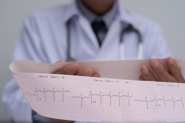 terheléses EKG, szív, koszorúerek, szív- érrendszer, szívritmuszavar, szívbetegség