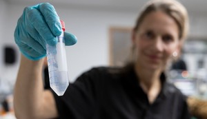 Donor sperme imao genetsku mutaciju koja izaziva rak